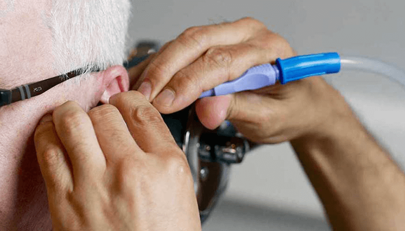 ear wax removal near me orlando fl