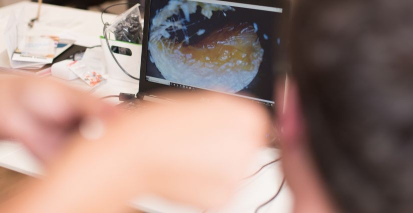 Ear Wax Removal Stockport image