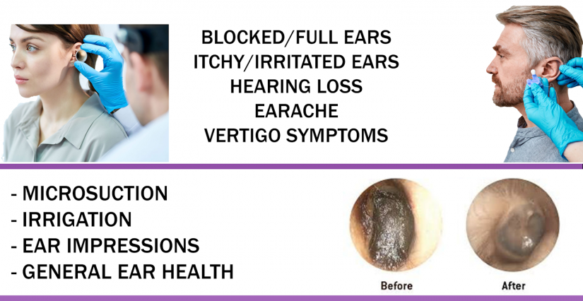 Ear Wax Removal Nailsea image