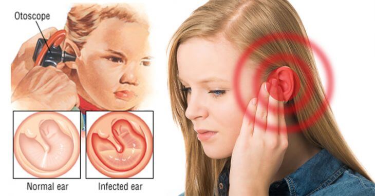Ear conditions in winter: how can I prevent the most common?