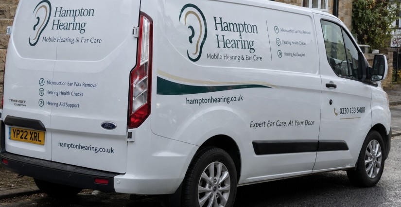 Ear Wax Removal Sheffield image